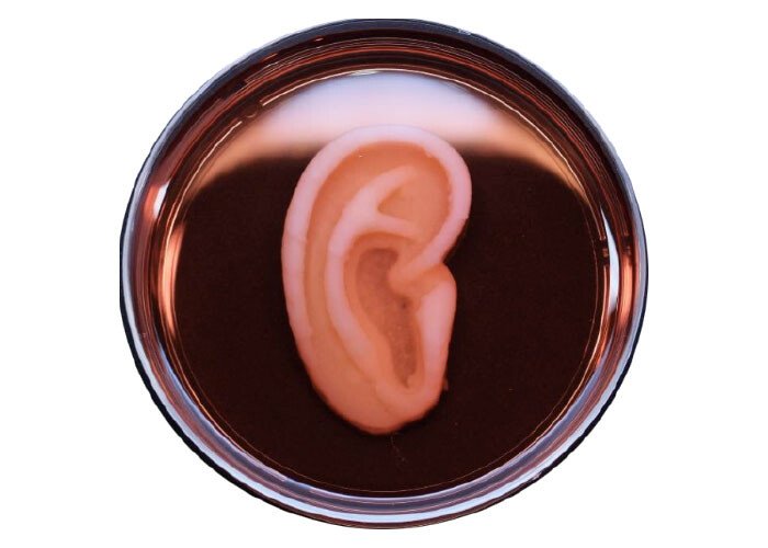 oreja bionica