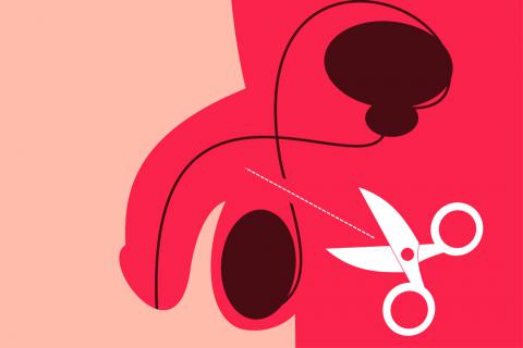 Practican por error vasectomía en niño de 4 años