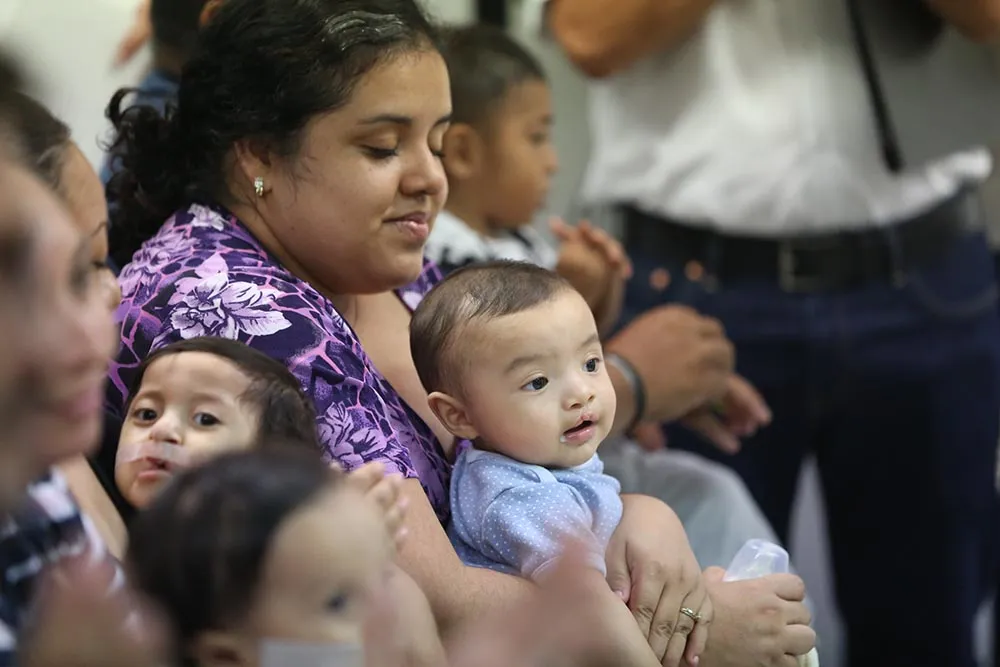 Península de Yucatán con alta incidencia de malformaciones de labio y paladar