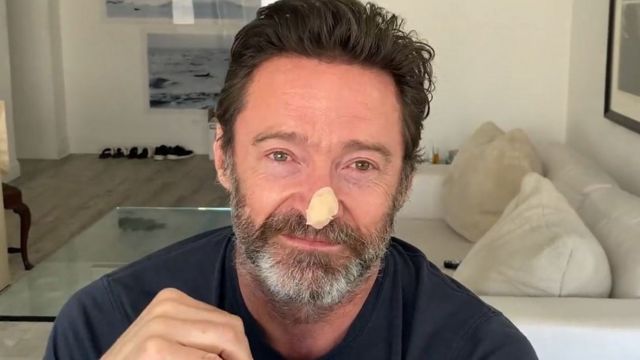 Hugh Jackman dio negativo a cancer de piel