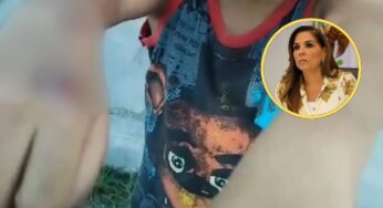¡Con los niños NO! Mara Lezama exige todo el peso de la ley para sujeto que quemó con un cigarro a menor en PDC