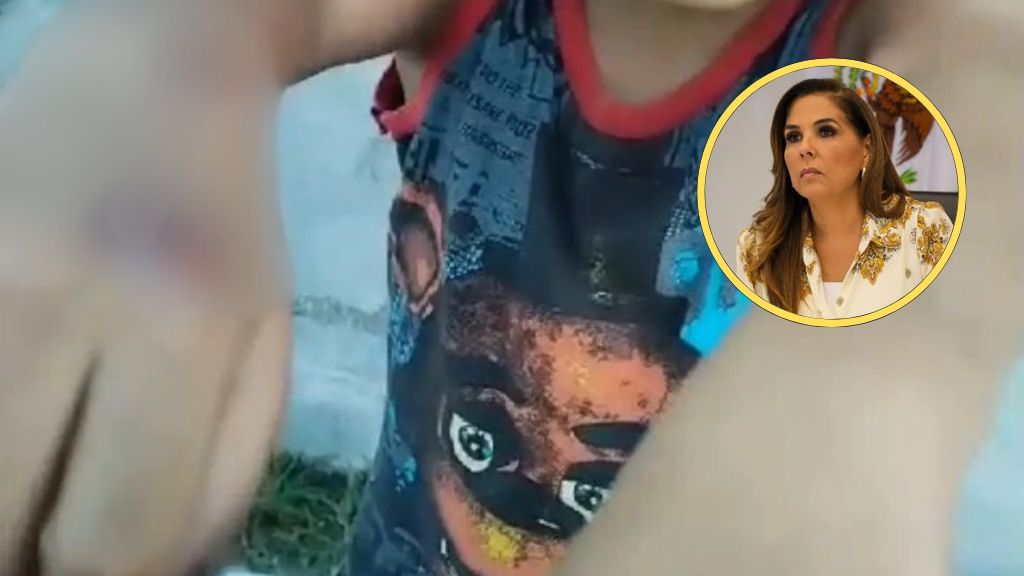 ¡Con los niños NO! Mara Lezama exige todo el peso de la ley para sujeto que quemó con un cigarro a menor en PDC