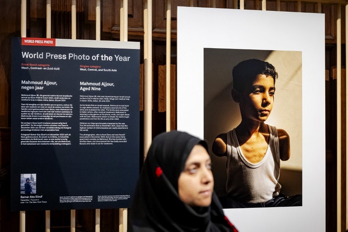 Imagen de un niño palestino amputado ganó el premio World Press Photo