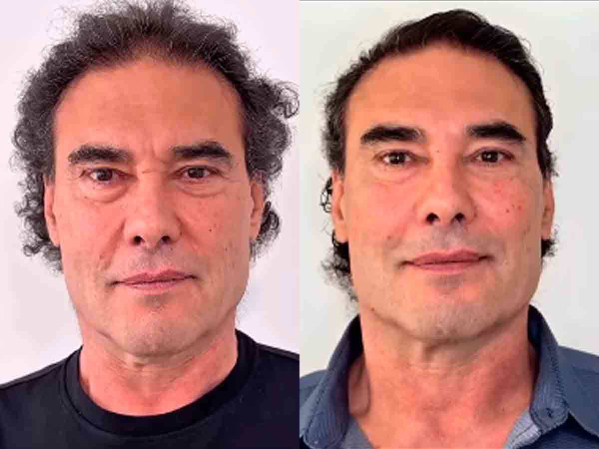 Eduardo Yáñez se somete a tratamiento para ser más joven