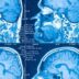 Científicos identifican dos subtipos biológicos del autismo